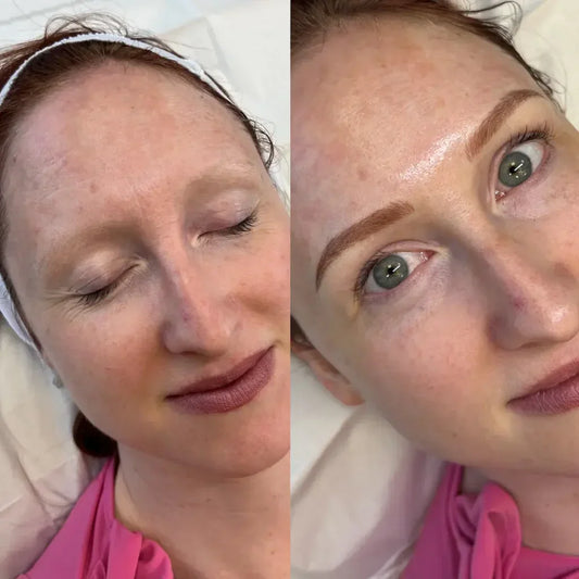 What is the recovery time for eyebrow microblading?