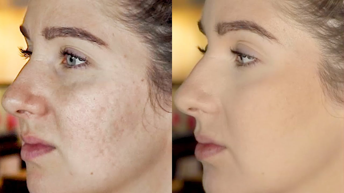 Does Diva Beauty Shop provide makeup services for individuals with scars or skin conditions?