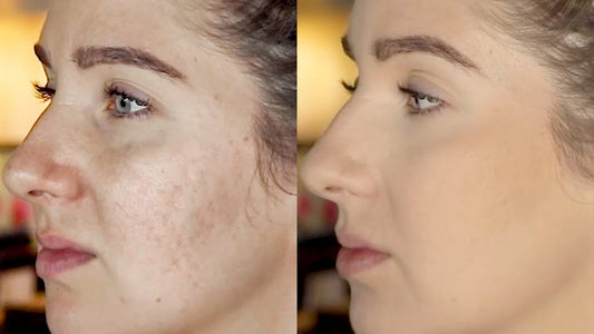 Does Diva Beauty Shop provide makeup services for individuals with scars or skin conditions?